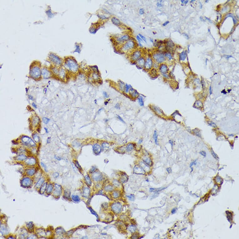 Immunohistochemistry - Anti-ACADL/LCAD Antibody (A13416) - Antibodies.com