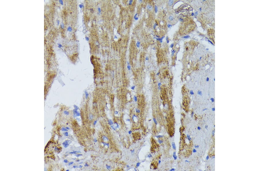 Immunohistochemistry - Anti-ACADL/LCAD Antibody (A13416) - Antibodies.com