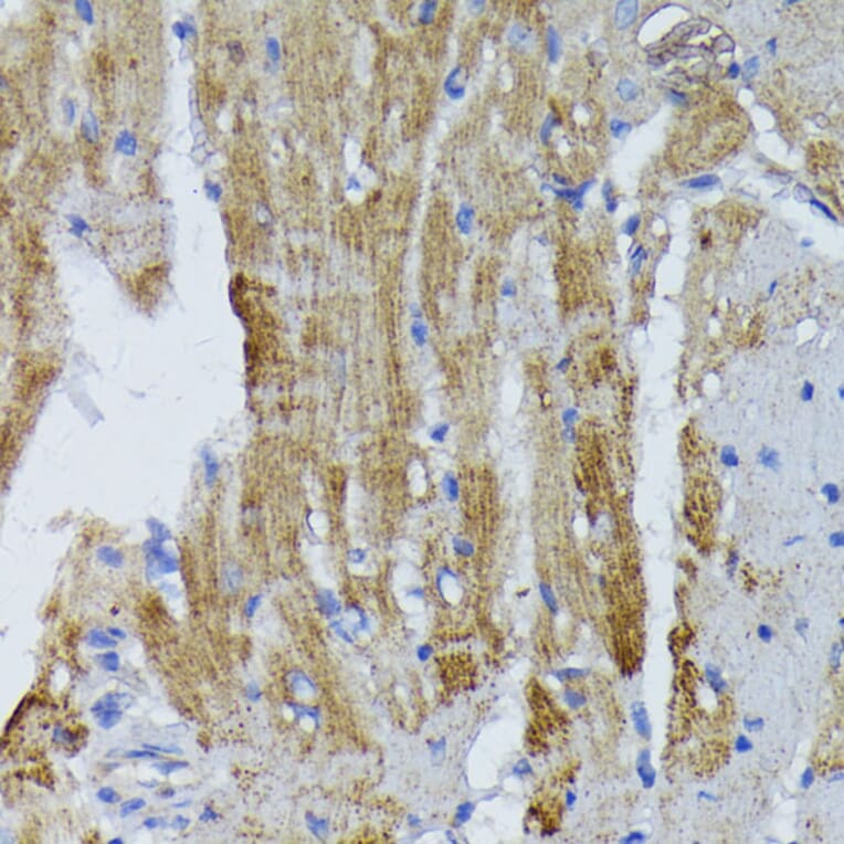 Immunohistochemistry - Anti-ACADL/LCAD Antibody (A13416) - Antibodies.com