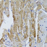 Immunohistochemistry - Anti-ACADL/LCAD Antibody (A13416) - Antibodies.com