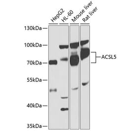 Western Blot - Anti-ACSL5 Antibody (A13417) - Antibodies.com