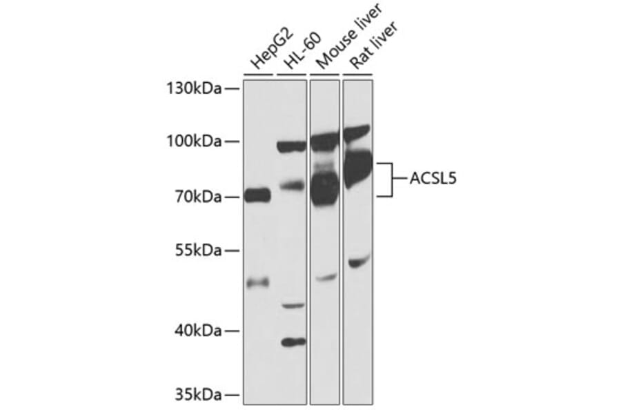 Western Blot - Anti-ACSL5 Antibody (A13417) - Antibodies.com