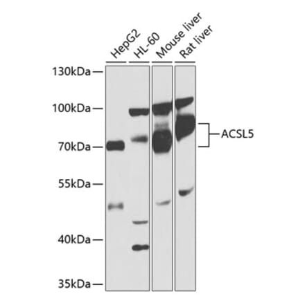 Western Blot - Anti-ACSL5 Antibody (A13417) - Antibodies.com