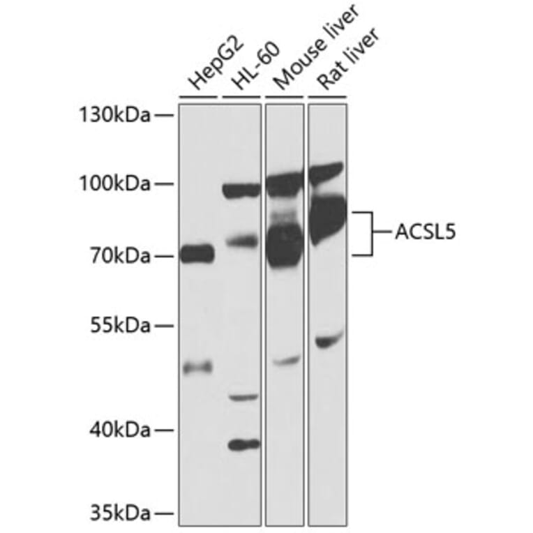 Western Blot - Anti-ACSL5 Antibody (A13417) - Antibodies.com