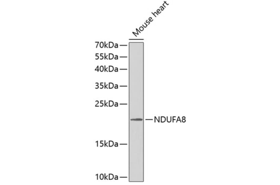 Western Blot - Anti-NDUFA8 Antibody (A1272) - Antibodies.com
