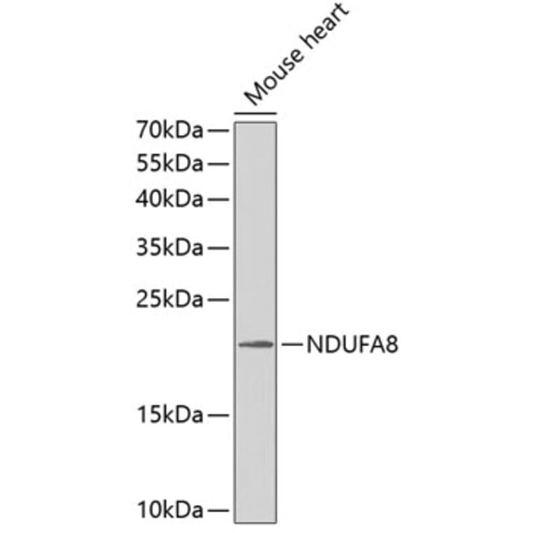Western Blot - Anti-NDUFA8 Antibody (A1272) - Antibodies.com