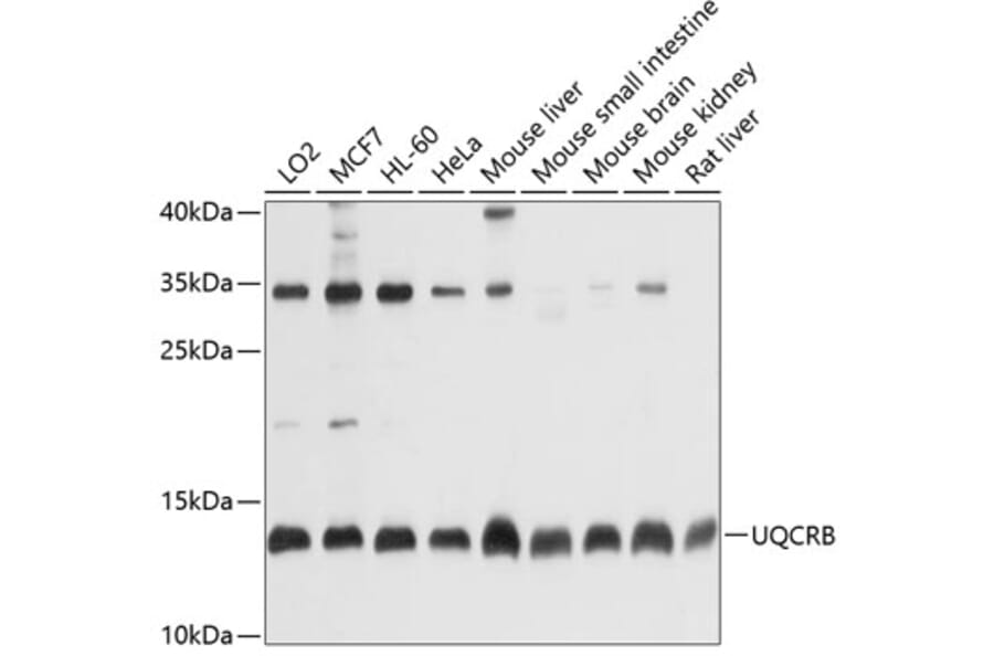 Western Blot - Anti-UQCRB Antibody (A13419) - Antibodies.com