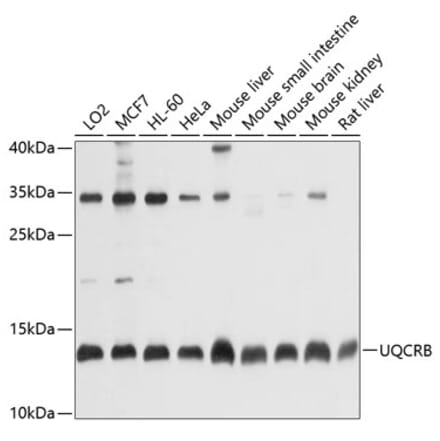 Western Blot - Anti-UQCRB Antibody (A13419) - Antibodies.com