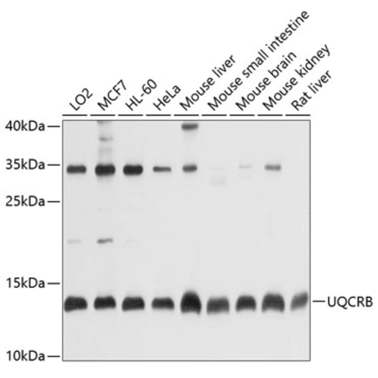 Western Blot - Anti-UQCRB Antibody (A13419) - Antibodies.com