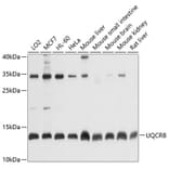 Western Blot - Anti-UQCRB Antibody (A13419) - Antibodies.com