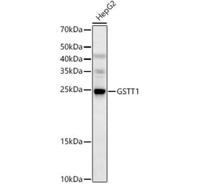 Western Blot - Anti-GSTT1 Antibody (A13420) - Antibodies.com