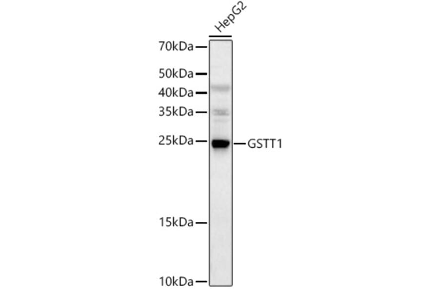 Western Blot - Anti-GSTT1 Antibody (A13420) - Antibodies.com