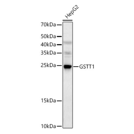 Western Blot - Anti-GSTT1 Antibody (A13420) - Antibodies.com