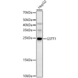 Western Blot - Anti-GSTT1 Antibody (A13420) - Antibodies.com