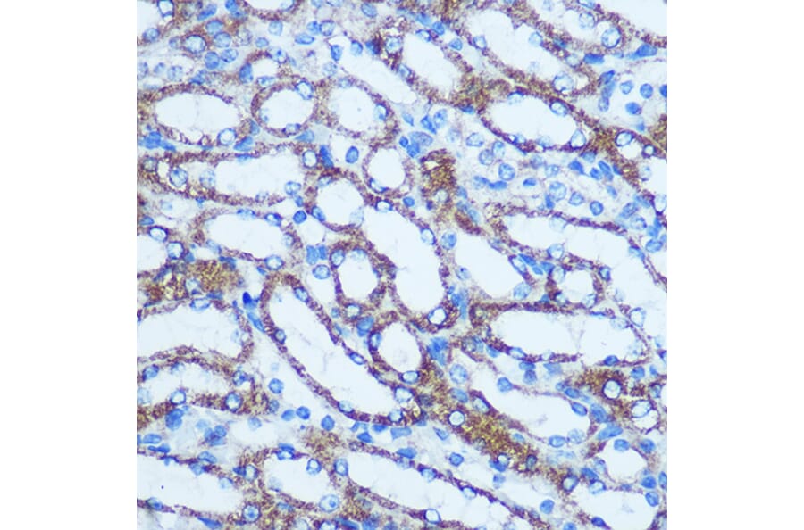 Immunohistochemistry - Anti-GSTT1 Antibody (A13420) - Antibodies.com