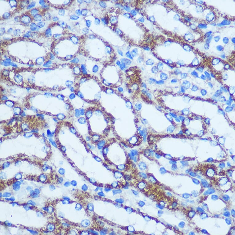 Immunohistochemistry - Anti-GSTT1 Antibody (A13420) - Antibodies.com