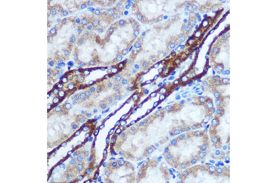 Immunohistochemistry - Anti-GSTT1 Antibody (A13420) - Antibodies.com