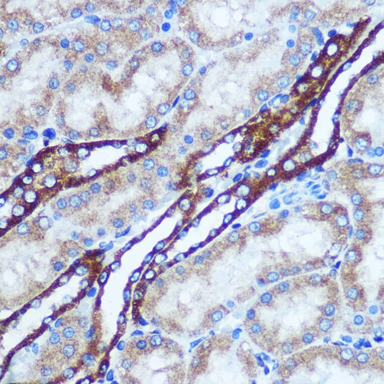 Immunohistochemistry - Anti-GSTT1 Antibody (A13420) - Antibodies.com