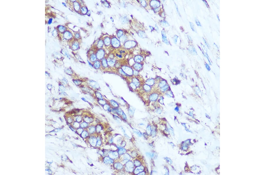 Immunohistochemistry - Anti-GSTT1 Antibody (A13420) - Antibodies.com