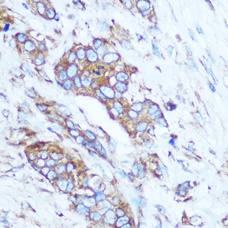 Immunohistochemistry - Anti-GSTT1 Antibody (A13420) - Antibodies.com
