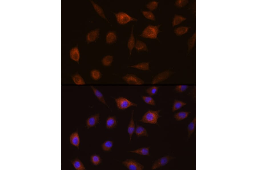 Immunofluorescence - Anti-GSTT1 Antibody (A13420) - Antibodies.com