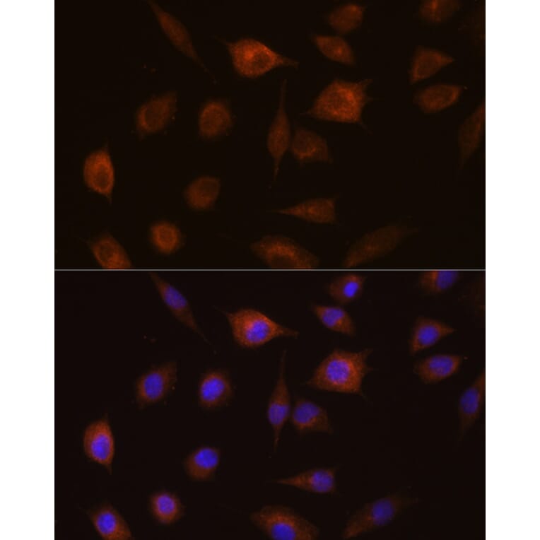 Immunofluorescence - Anti-GSTT1 Antibody (A13420) - Antibodies.com