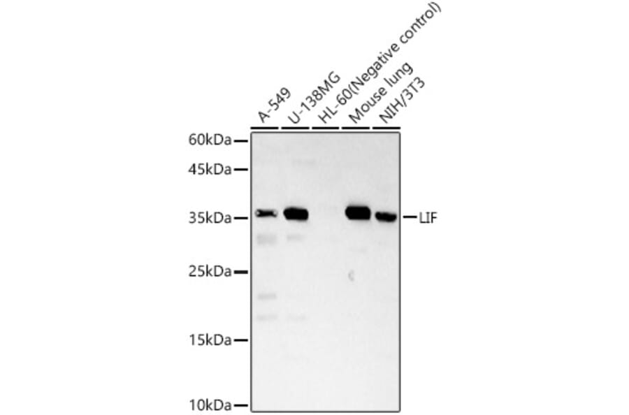 Western Blot - Anti-LIF Antibody (A13421) - Antibodies.com