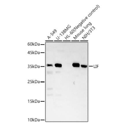 Western Blot - Anti-LIF Antibody (A13421) - Antibodies.com