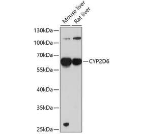 Western Blot - Anti-CYP2D6 Antibody (A13422) - Antibodies.com