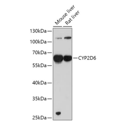 Western Blot - Anti-CYP2D6 Antibody (A13422) - Antibodies.com
