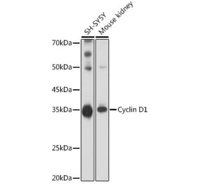 Western Blot - Anti-Cyclin D1 Antibody (A13423) - Antibodies.com