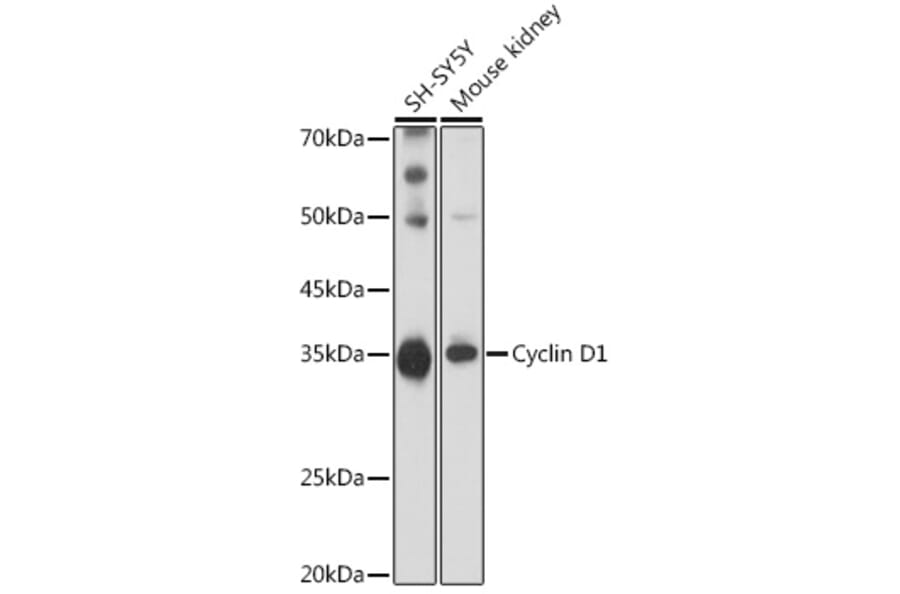 Western Blot - Anti-Cyclin D1 Antibody (A13423) - Antibodies.com