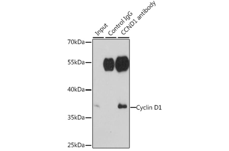 Immunoprecipitation - Anti-Cyclin D1 Antibody (A13423) - Antibodies.com