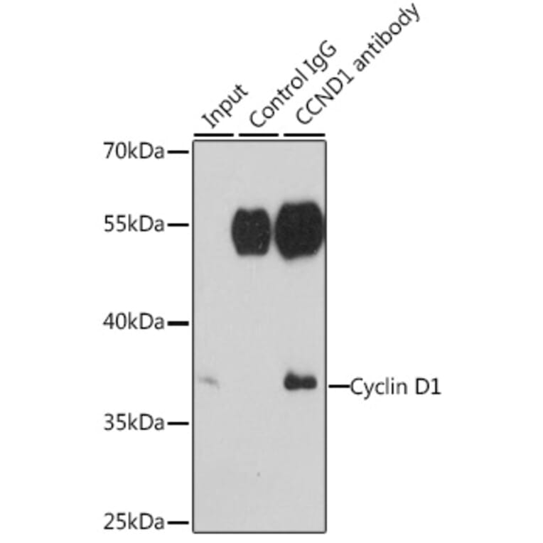 Immunoprecipitation - Anti-Cyclin D1 Antibody (A13423) - Antibodies.com