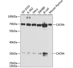 Western Blot - Anti-CXCR4 Antibody (A13424) - Antibodies.com