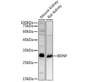 Western Blot - Anti-BDNF Antibody (A13426) - Antibodies.com