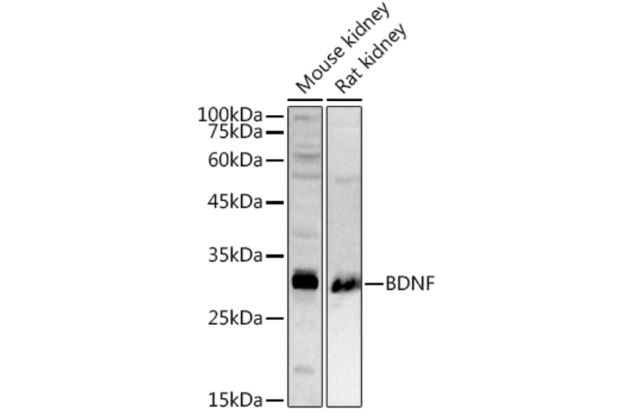Anti-BDNF Antibody (A13426) | Antibodies.com