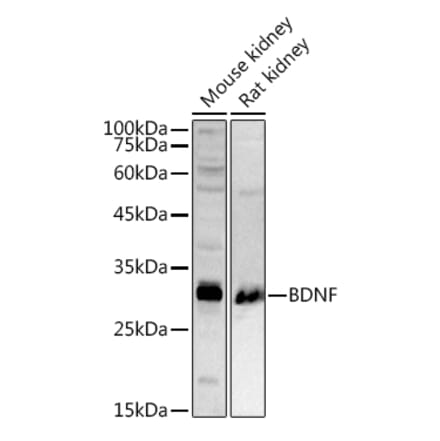 Western Blot - Anti-BDNF Antibody (A13426) - Antibodies.com