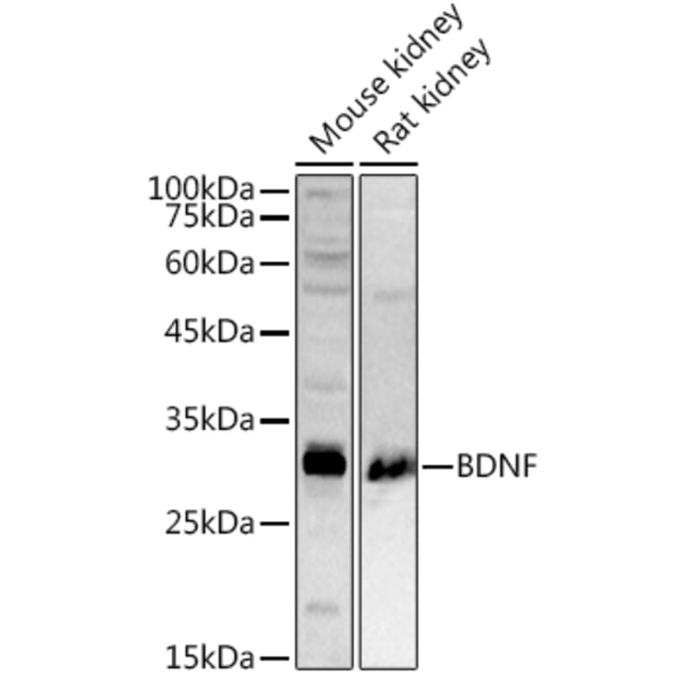 Western Blot - Anti-BDNF Antibody (A13426) - Antibodies.com