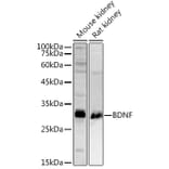 Western Blot - Anti-BDNF Antibody (A13426) - Antibodies.com