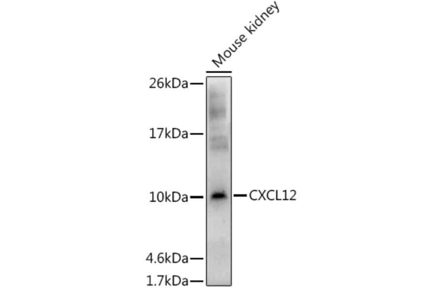 Western Blot - Anti-SDF1 Antibody (A13428) - Antibodies.com