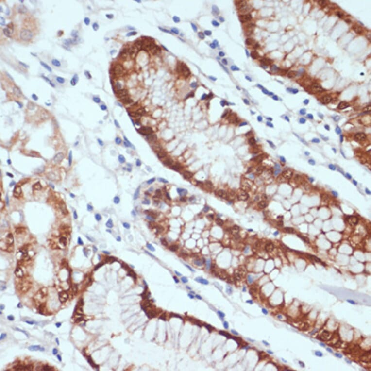 Immunohistochemistry - Anti-SDF1 Antibody (A13428) - Antibodies.com