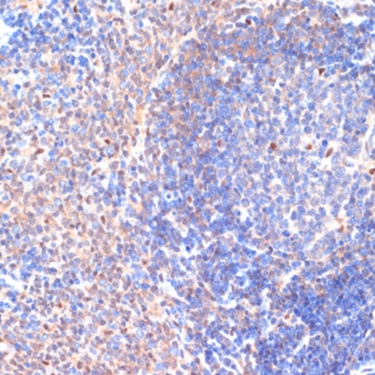 Immunohistochemistry - Anti-SDF1 Antibody (A13428) - Antibodies.com