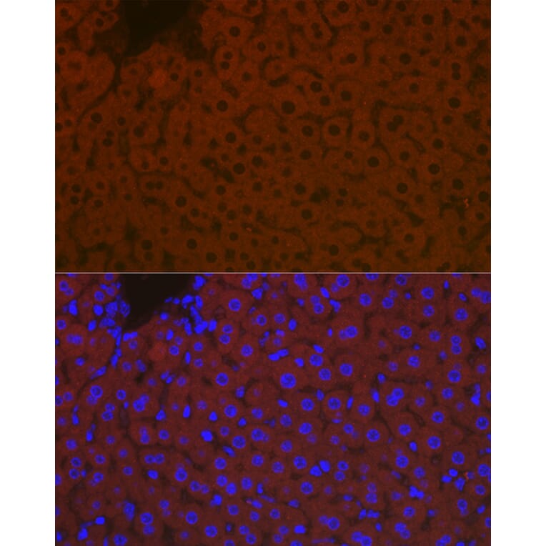 Immunofluorescence - Anti-Apolipoprotein B Antibody (A13429) - Antibodies.com