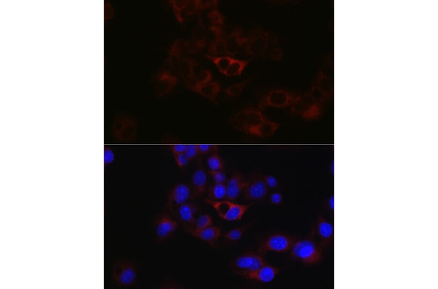Immunofluorescence - Anti-Apolipoprotein B Antibody (A13429) - Antibodies.com