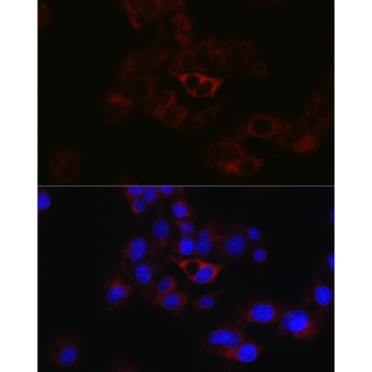 Immunofluorescence - Anti-Apolipoprotein B Antibody (A13429) - Antibodies.com