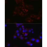 Immunofluorescence - Anti-Apolipoprotein B Antibody (A13429) - Antibodies.com
