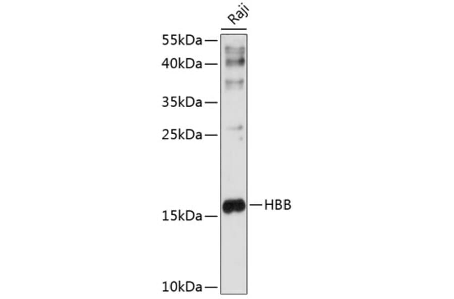 Western Blot - Anti-Hemoglobin subunit beta/ba1 Antibody (A13430) - Antibodies.com