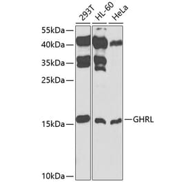 Western Blot - Anti-Ghrelin Antibody (A13431) - Antibodies.com
