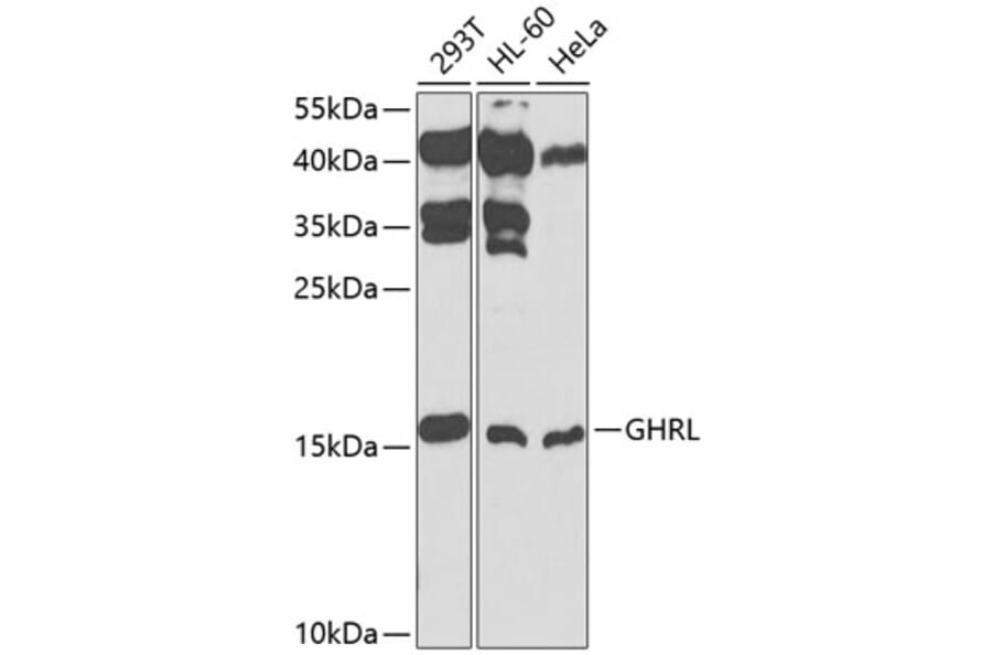 Western Blot - Anti-Ghrelin Antibody (A13431) - Antibodies.com